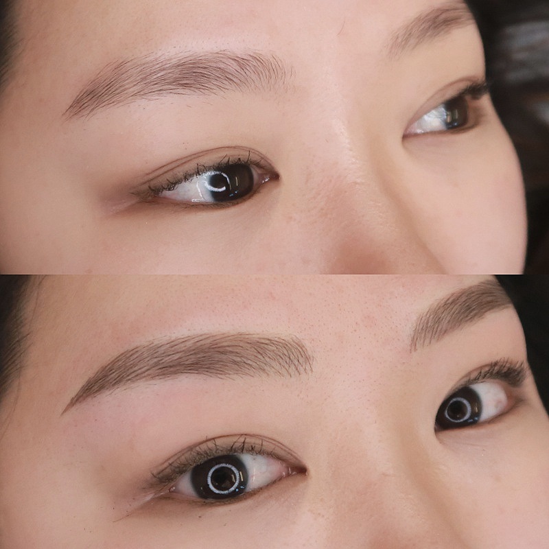 Micropigmentation