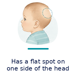 flat_spot_one_side_with_text_250x250_transparent.png