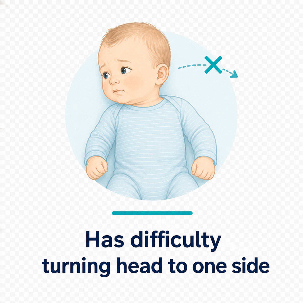 Difficulty turning head to one side.png