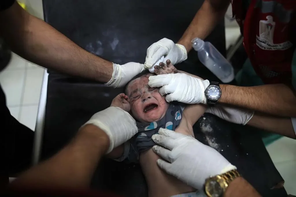 Baby_injured_Gaza.webp