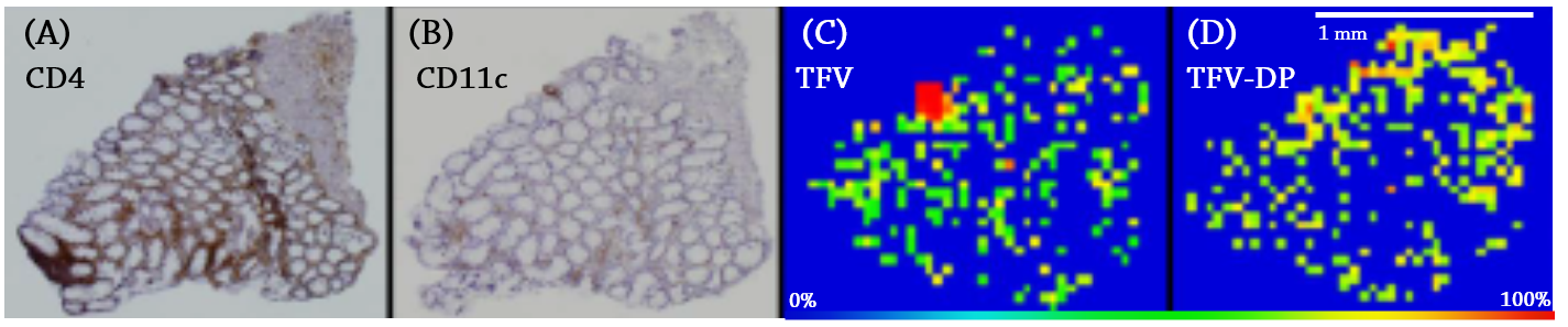 Figure 5. Histochemical staining of CD4+ T cells (A) and (B) CD11c dendritic cells in colorectal tissue biopsy sections. Brown color indicates positive staining. MALDI MS ion image of (C) TFV (m/z = 288.0860 Da) and (D) TFV-DP ( m/z = 448.0194 Da). Spatial resolution for MALDI MS ion images was 50 μm. The highest signal intensity (100%) is represented by red and the lowest signal is represented by blue for each ion of interest.