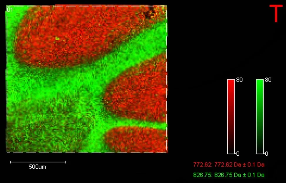 MALDI Mass Spectrometry Imaging of lipids in positive and negative ion ...