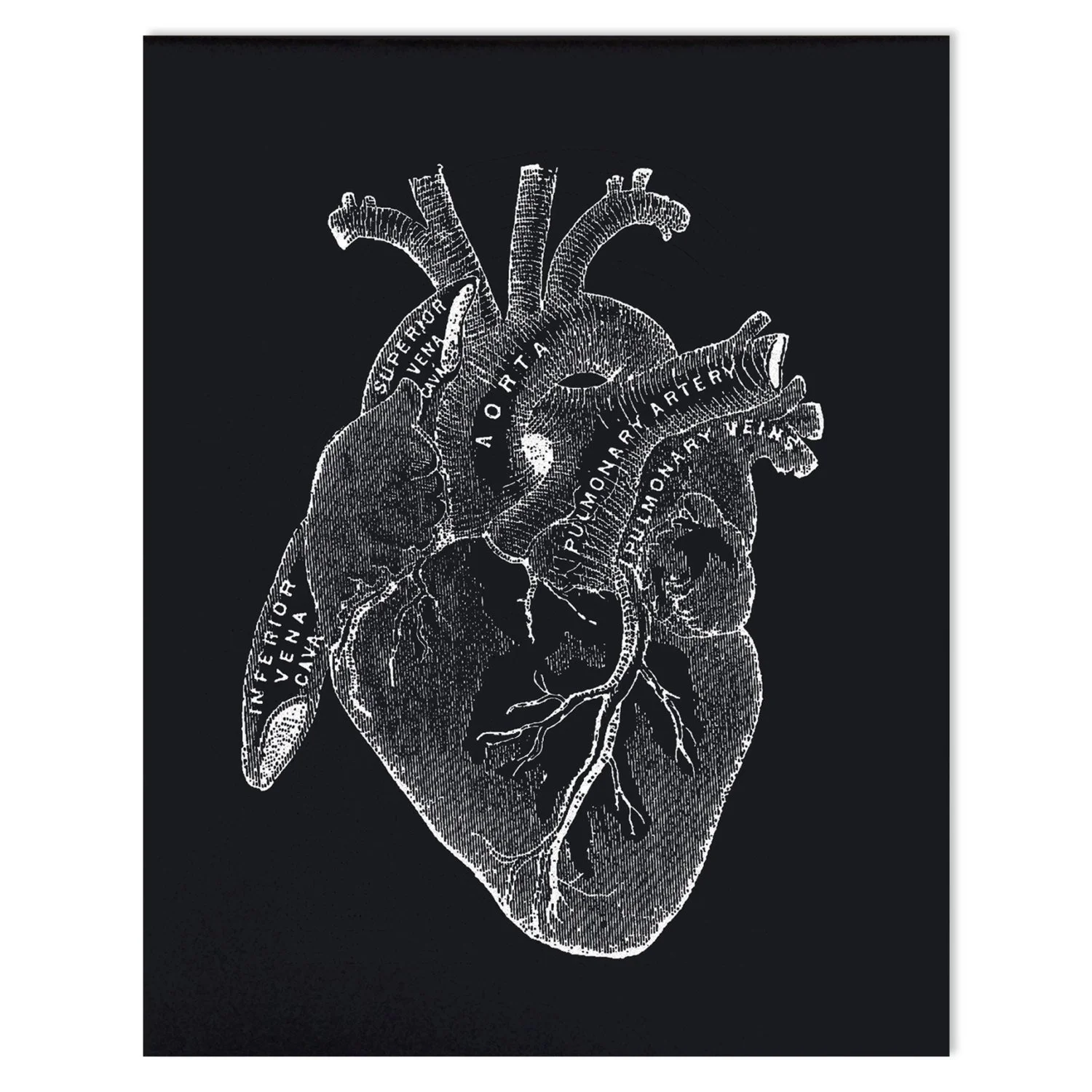 VINTAGE ANATOMY BLACK HEART PRINT.jpg