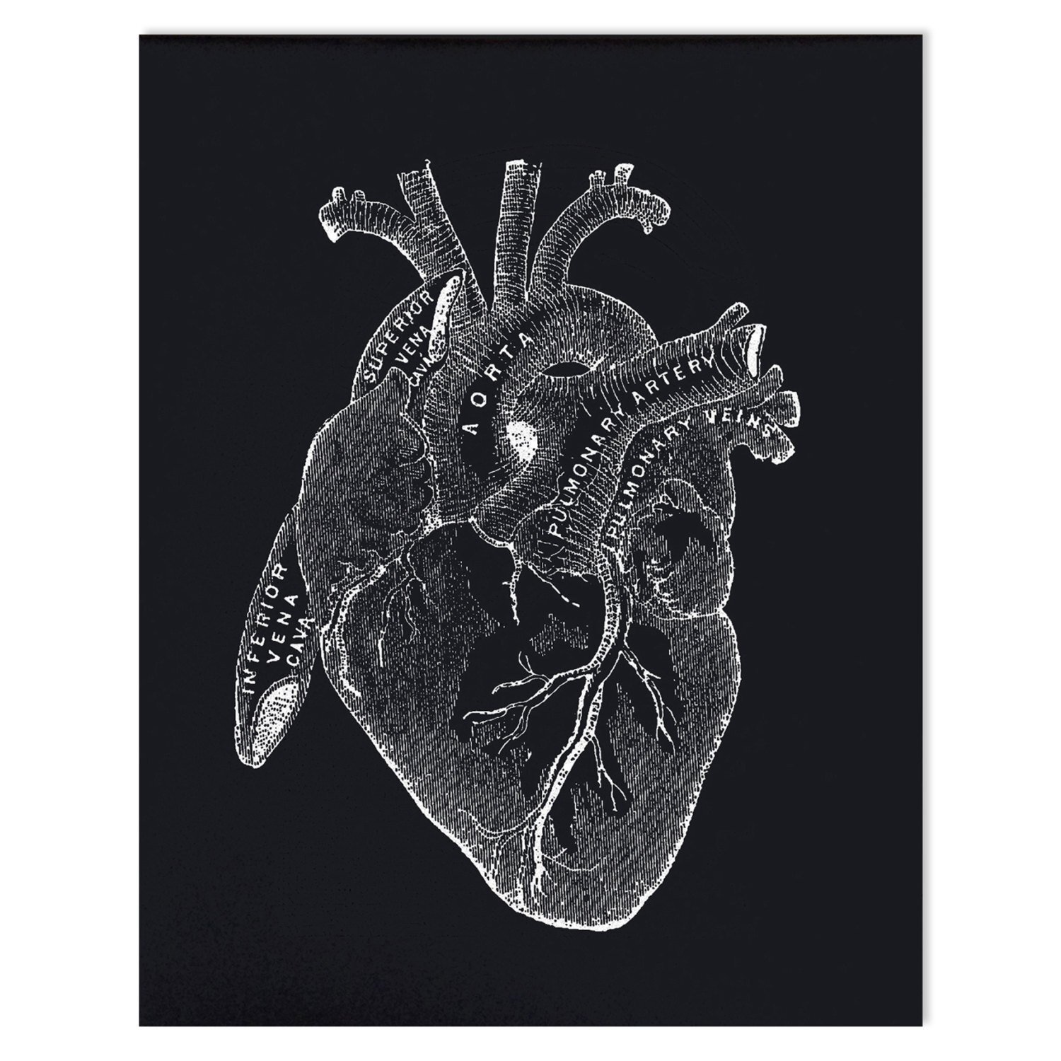 $19.99 VINTAGE ANATOMY BLACK HEART ART PRINT