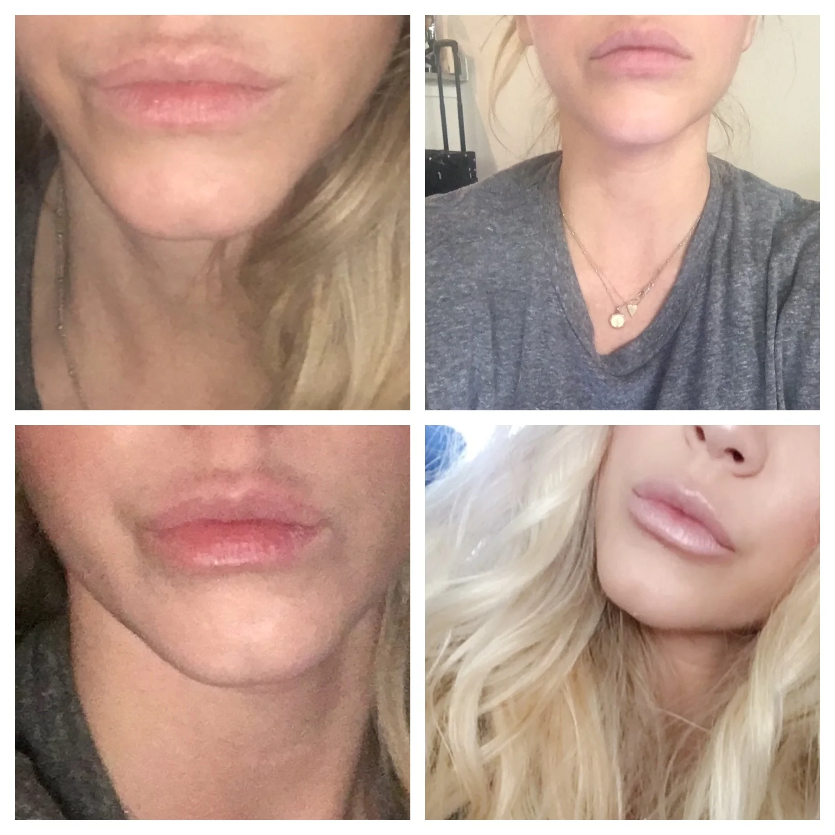 I hope you all enjoy the honesty and don't beat me down lol. I just want it to be ok for us ladies to talk about this and make it not so "taboo" that's all.. We are all beautiful the way we are but if something makes you feel better then by all means do it for YOU! xoxo Jess