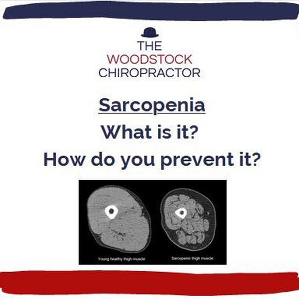 ❌ Sarcopenia ❌

Sarcopenia is the natural loss of muscle mass and strength as the body ages 👎

But your muscles are important! 💪

If Sarcopenia is allowed to progress it can result in: 

👉 Increased incidence of falling 
👉 Slowing walking speed 
