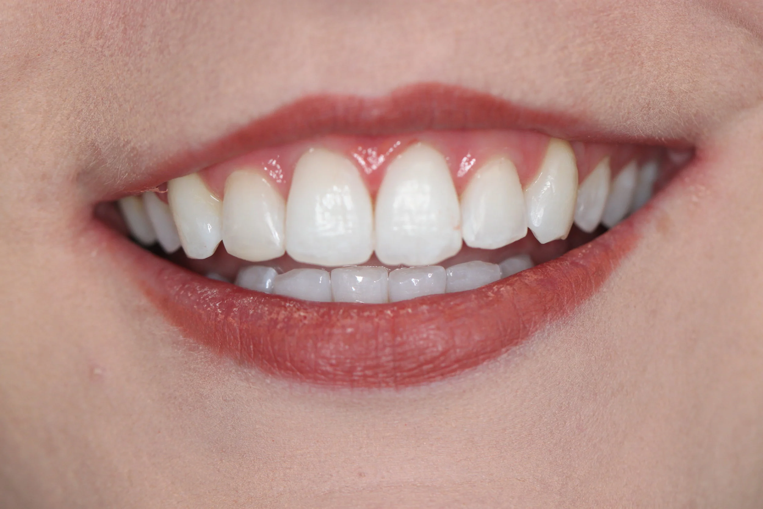 Cosmetic dentistry: Smile with confidence!