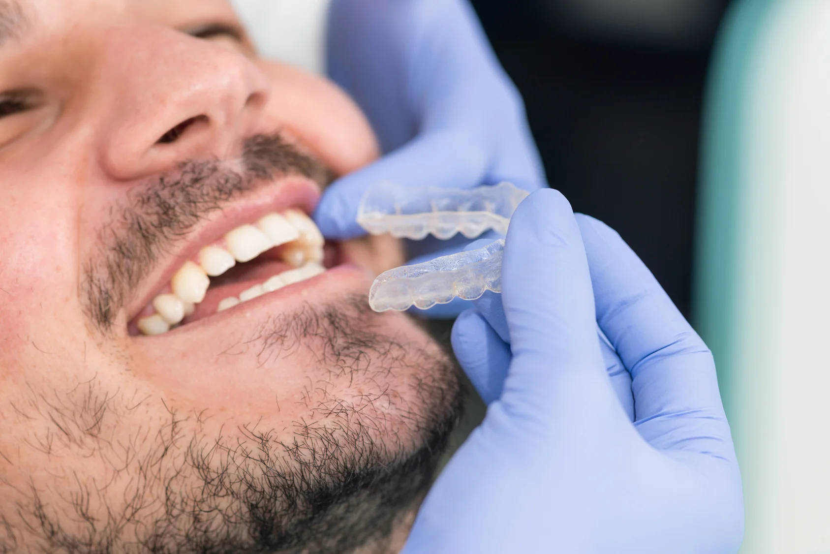 You don’t have to have a superstar salary to have a celebrity smile!