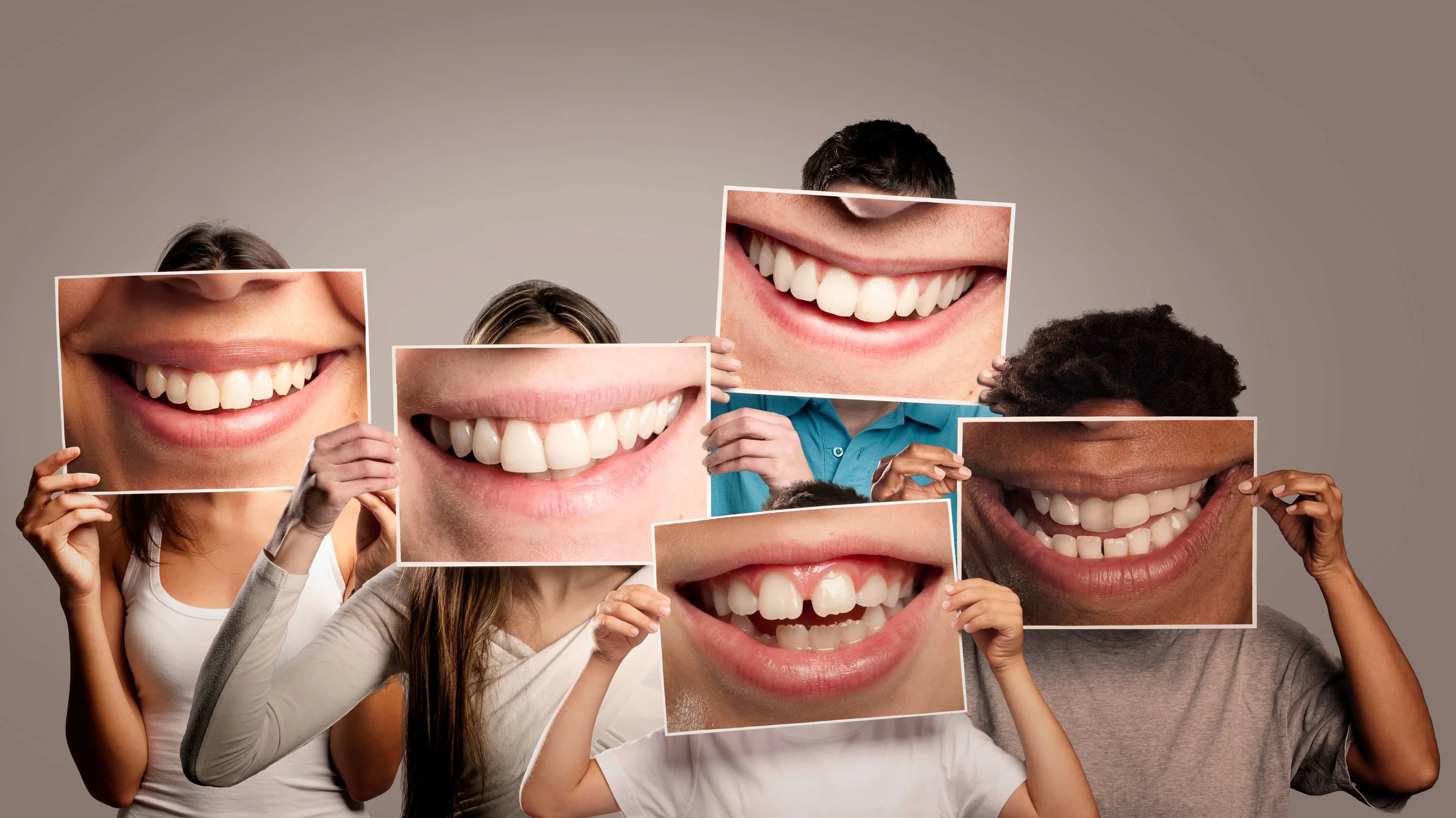 How we can replace missing teeth – Dental Implants