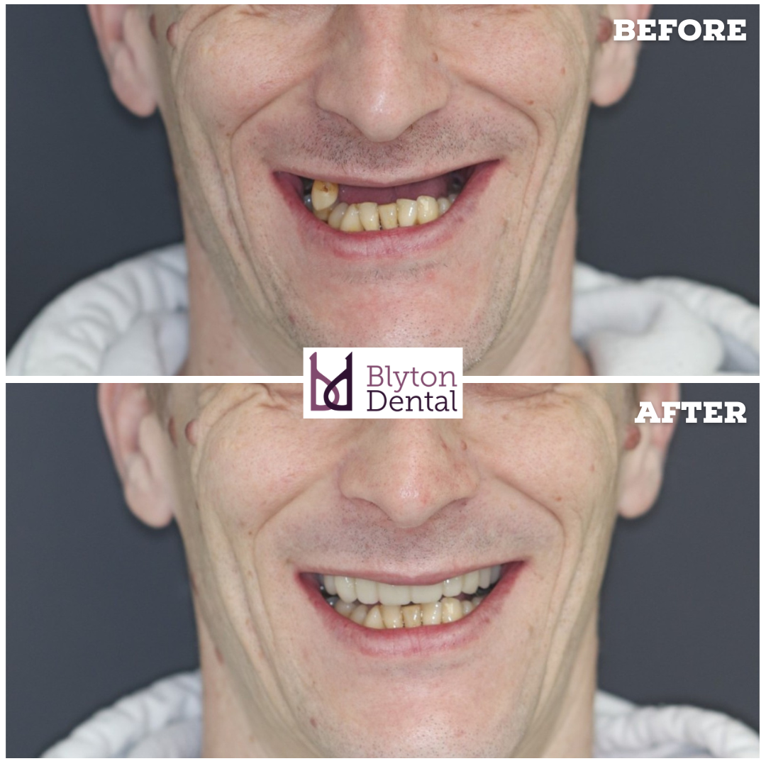 CASE 154 - BLYTON DENTAL.png