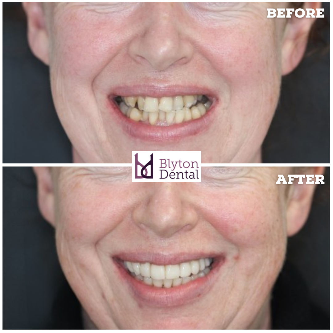 CASE 164 - BLYTON DENTAL.png