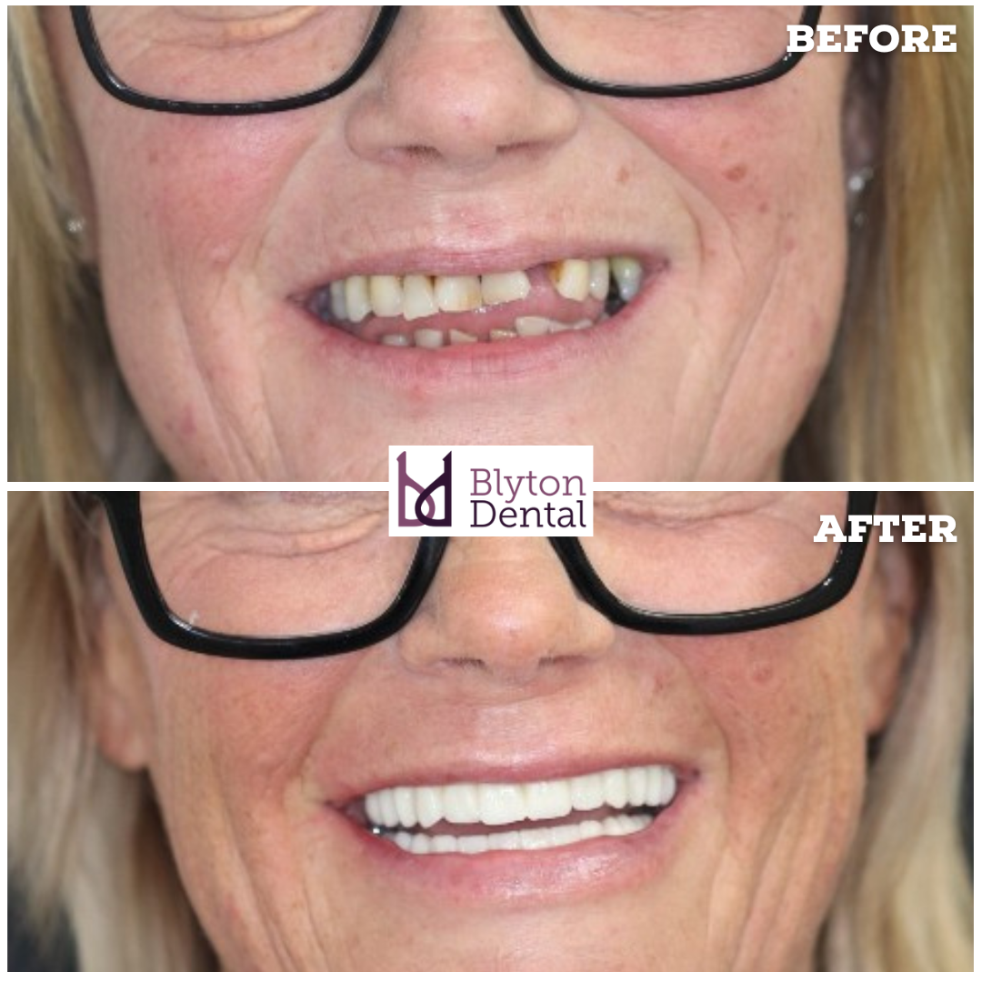 CASE 165 - BLYTON DENTAL.png