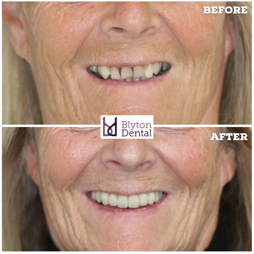 CASE 166 - BLYTON DENTAL.png