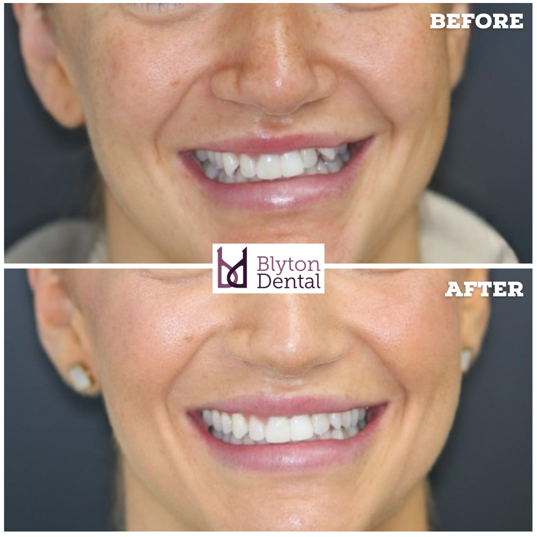 CASE 167 - BLYTON DENTAL.png