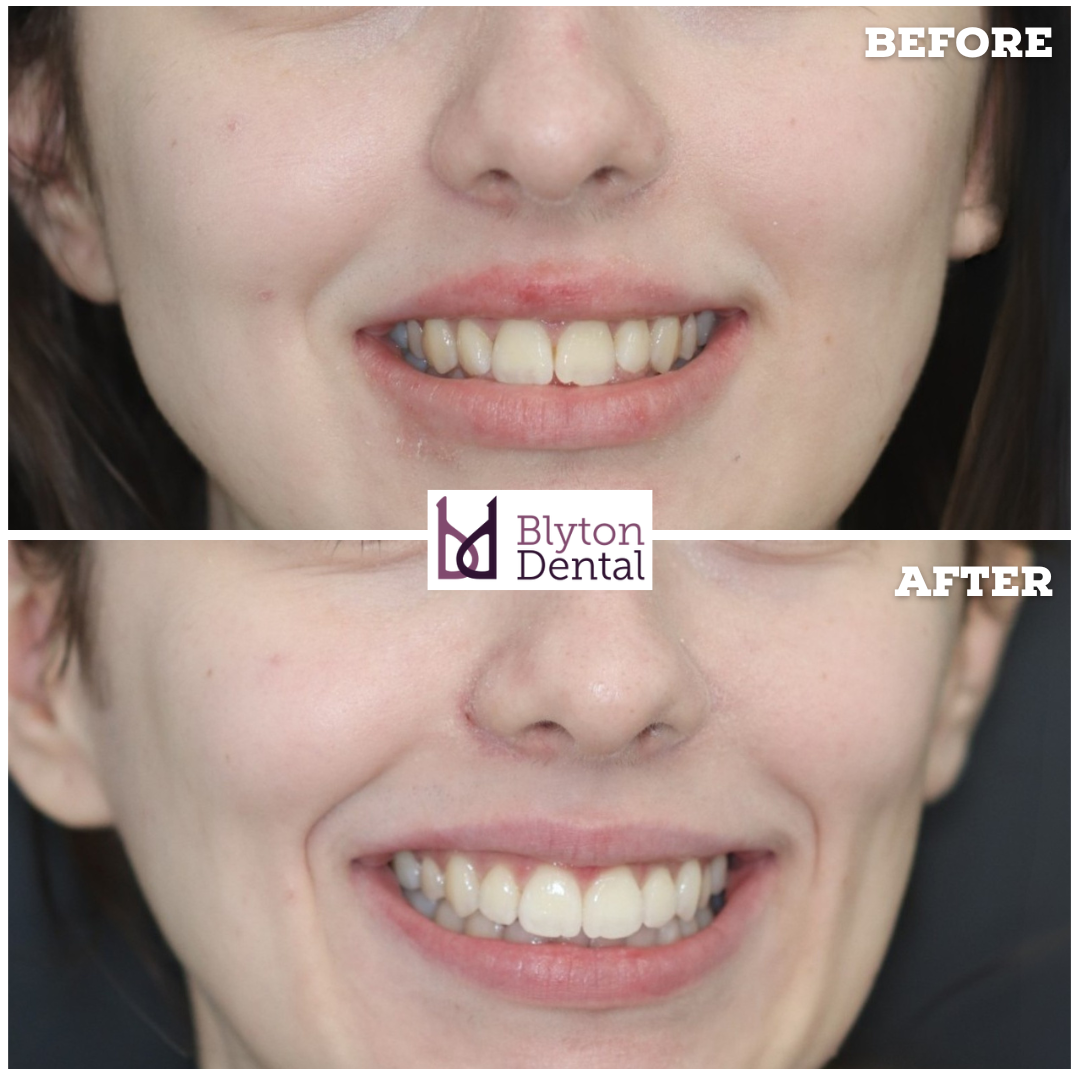 CASE 168 - BLYTON DENTAL.png