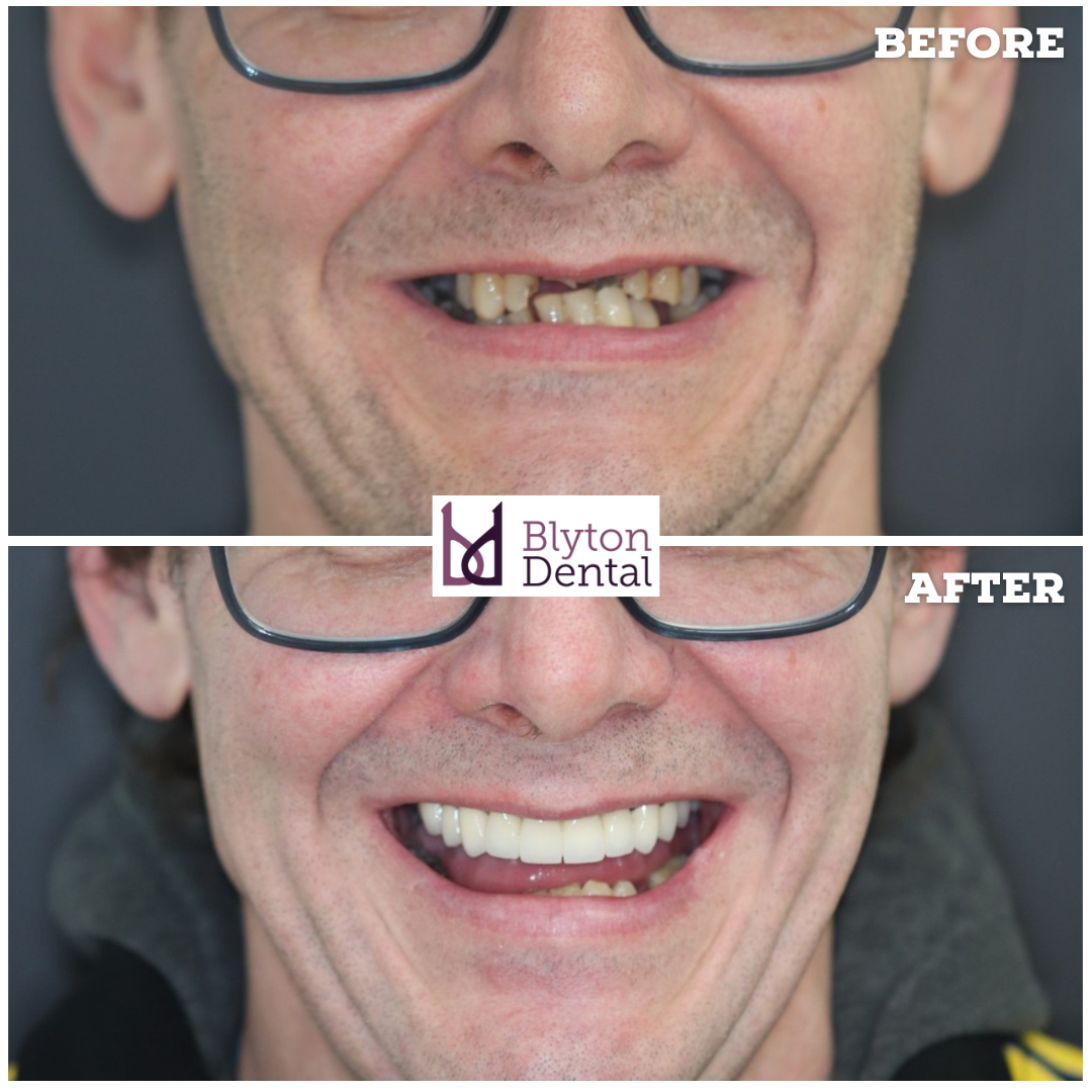 CASE 169 - BLYTON DENTAL.png