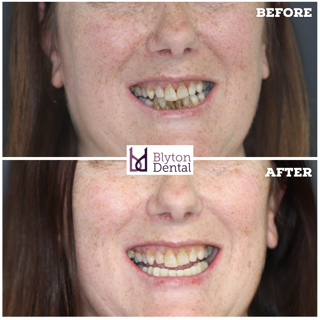 CASE 170 - BLYTON DENTAL.png