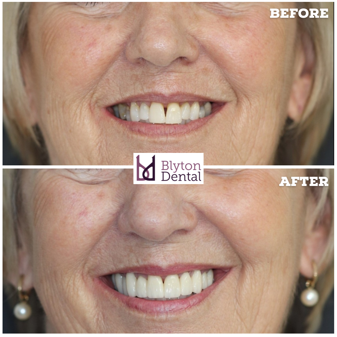 CASE 171 - BLYTON DENTAL.png