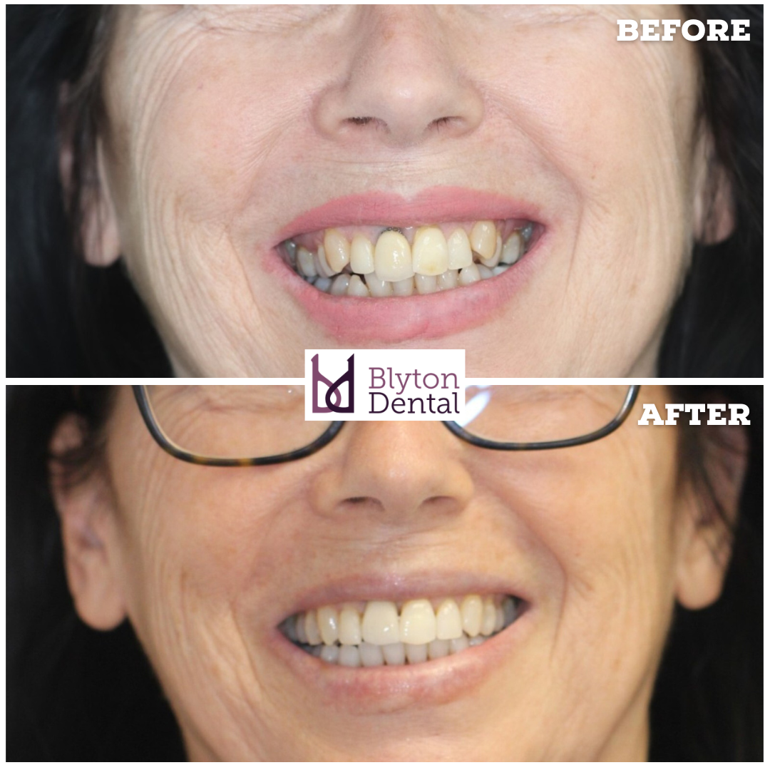 CASE 173 - BLYTON DENTAL.png