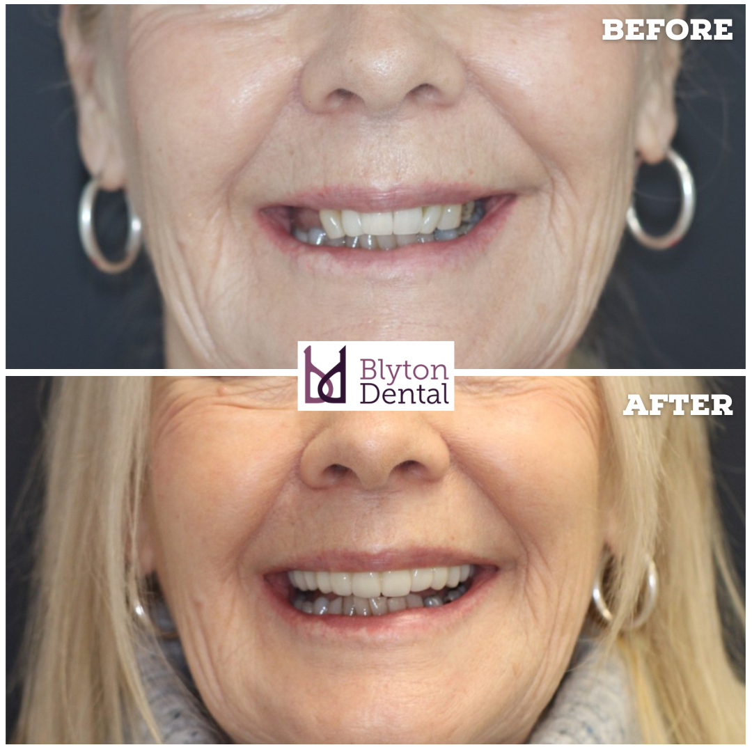 CASE 174 - BLYTON DENTAL.png