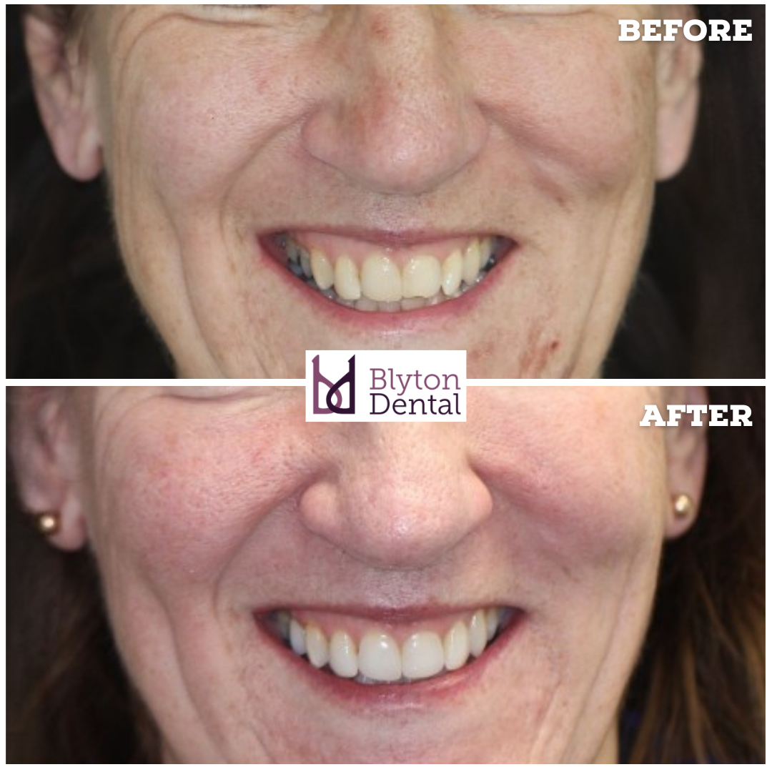 CASE 175 - BLYTON DENTAL.png