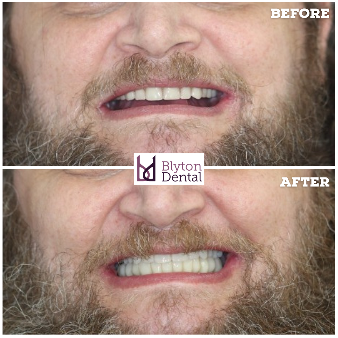CASE 178 - BLYTON DENTAL.png