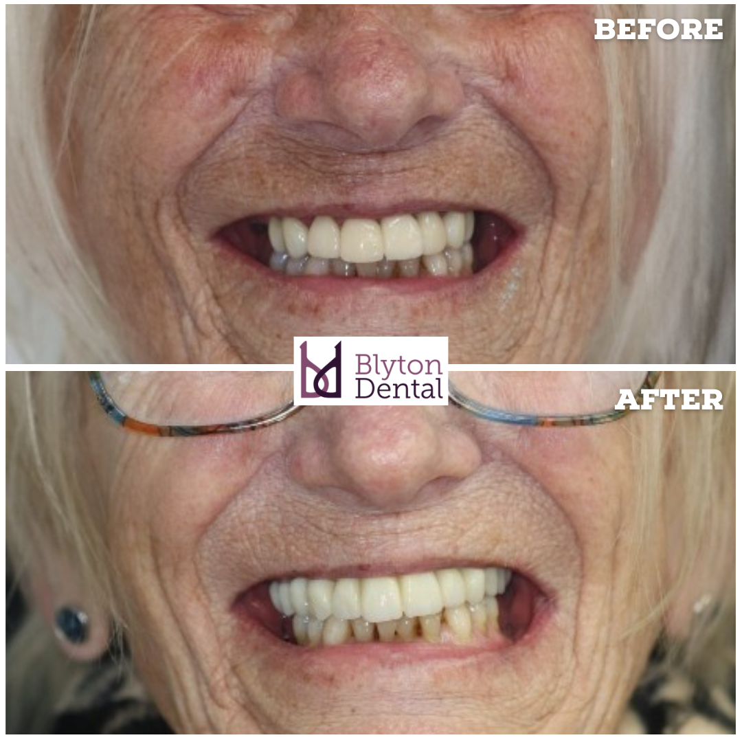 CASE 179 - BLYTON DENTAL.png