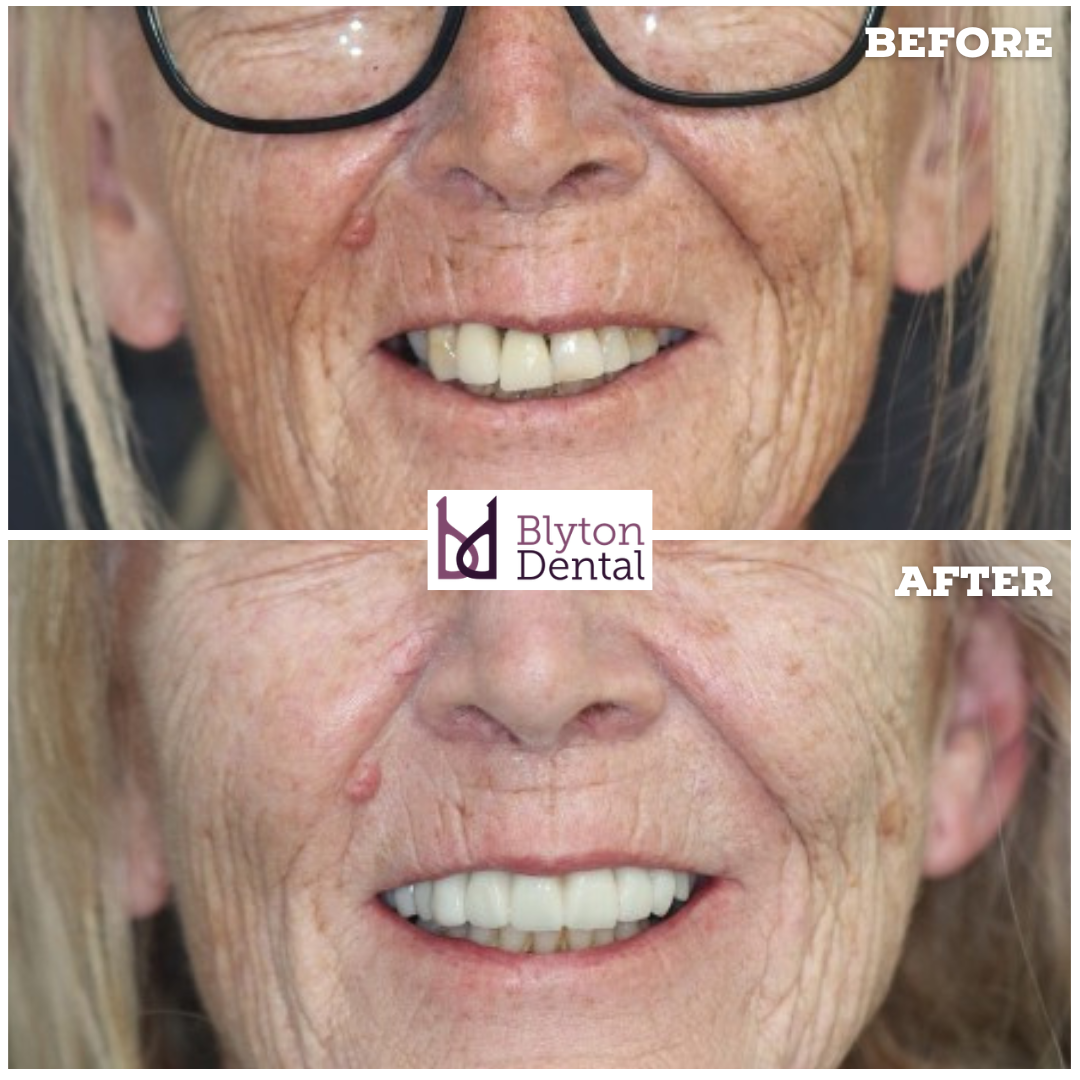 CASE 180 - BLYTON DENTAL.png