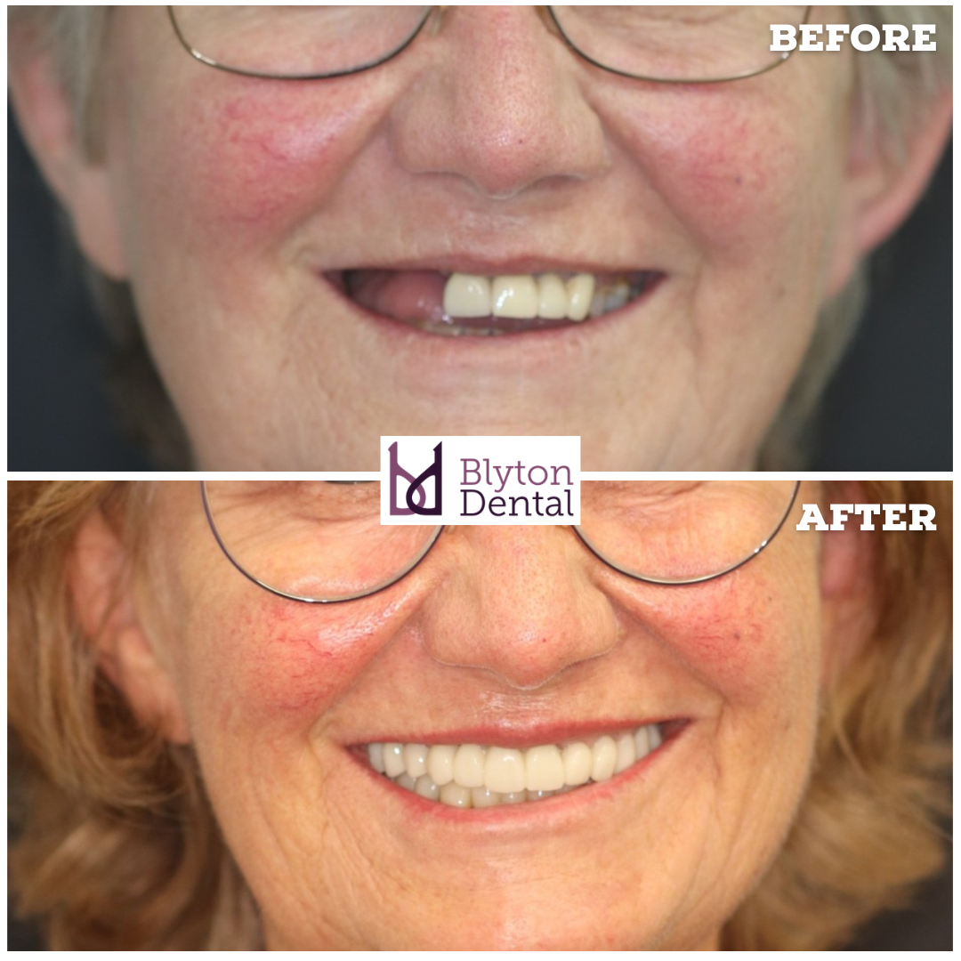 CASE 181 - BLYTON DENTAL.png