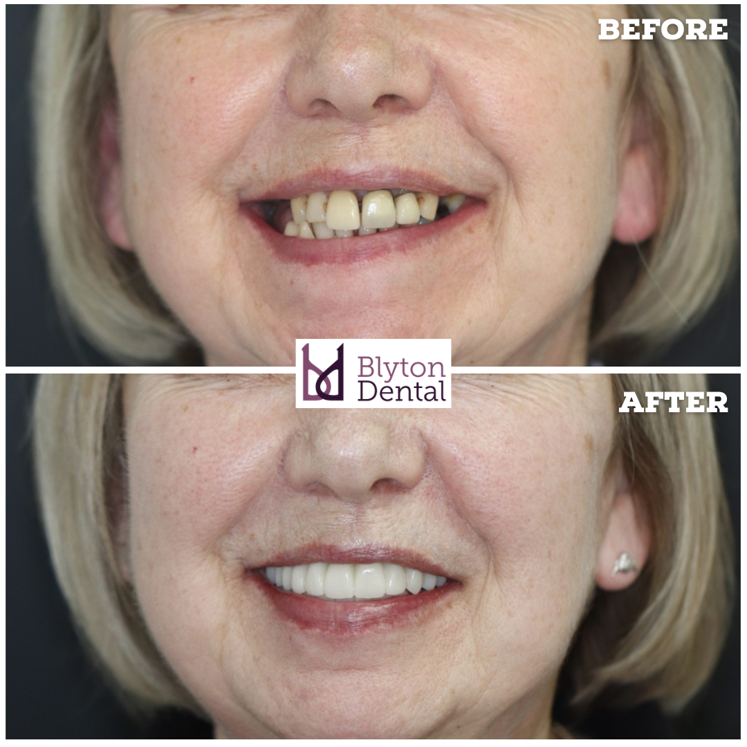 CASE 182 - BLYTON DENTAL.png