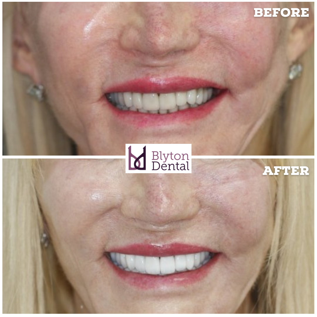 CASE 183 - BLYTON DENTAL.png