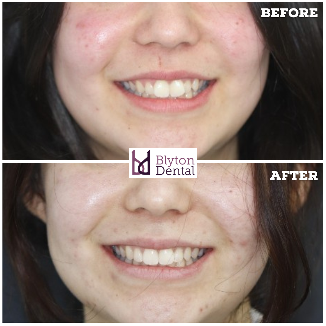 CASE 184 - BLYTON DENTAL.png