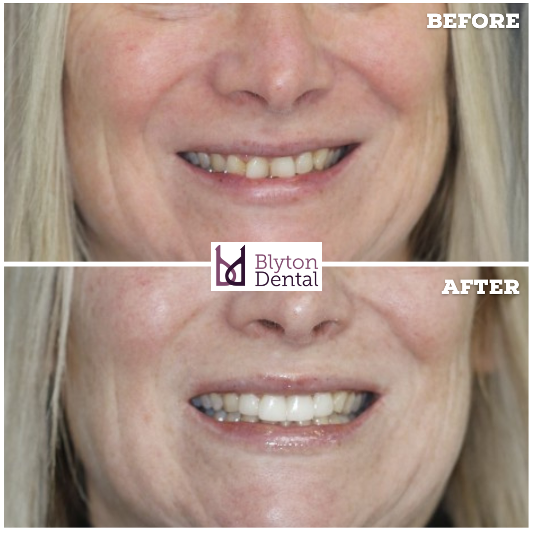CASE 185 - BLYTON DENTAL.png