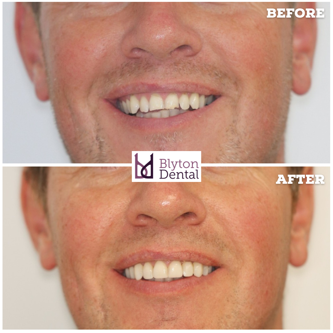 CASE 186 - BLYTON DENTAL.png