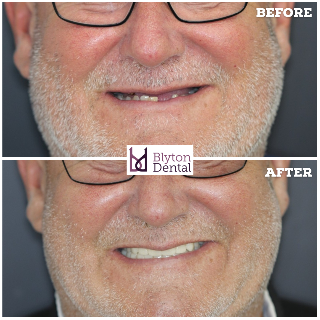 CASE 187 - BLYTON DENTAL.png