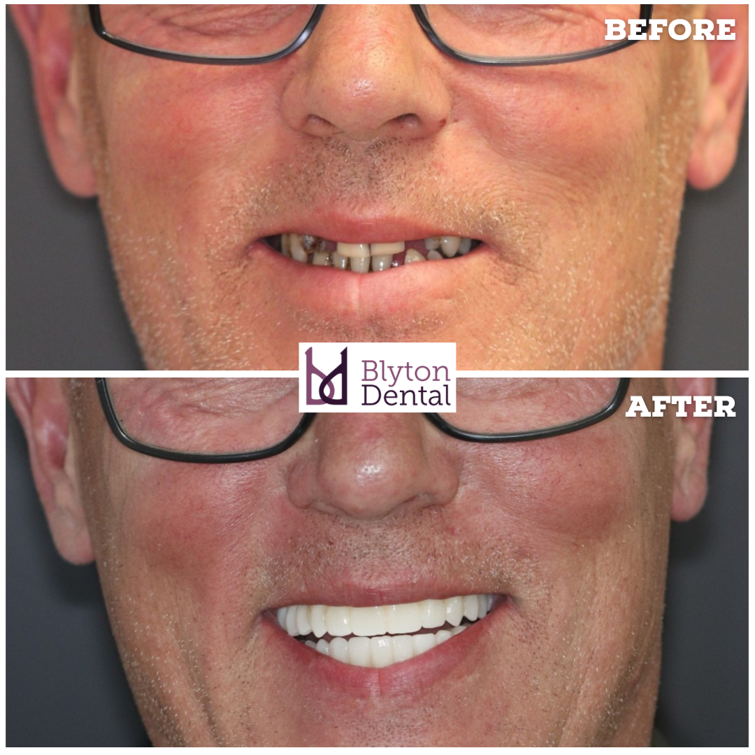 CASE 191 - BLYTON DENTAL.png