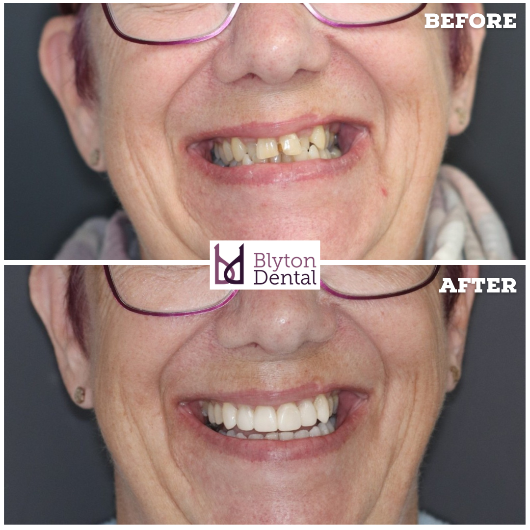 CASE 192 - BLYTON DENTAL.png