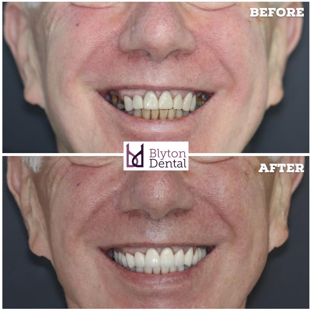 CASE 194 - BLYTON DENTAL.png