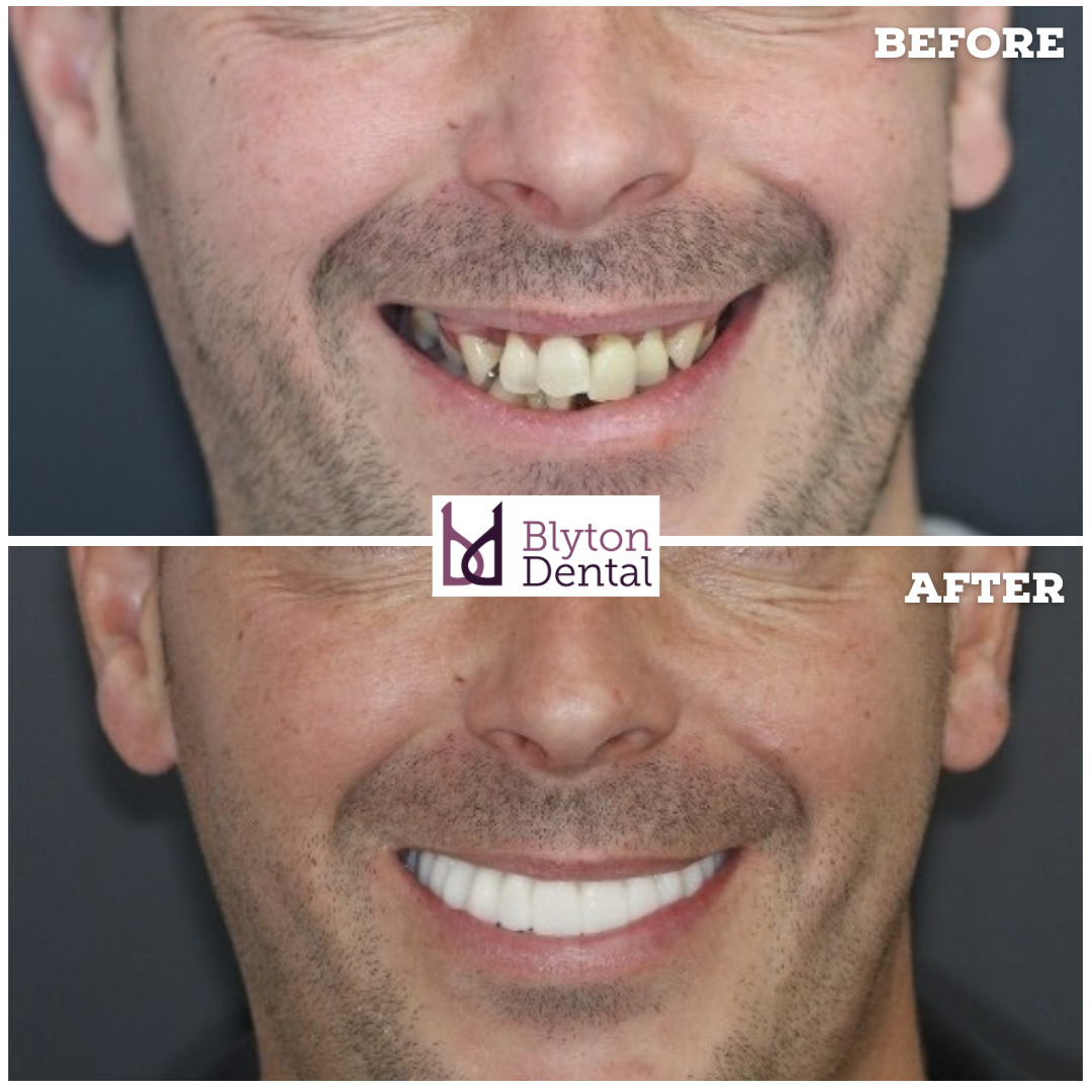 CASE 199 - BLYTON DENTAL.png