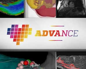 JHU-Advance-Thumbnail.jpg
