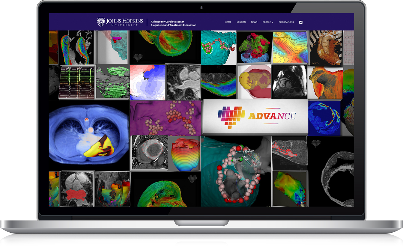 Johns-Hopkins-ADVANCE-1.jpg