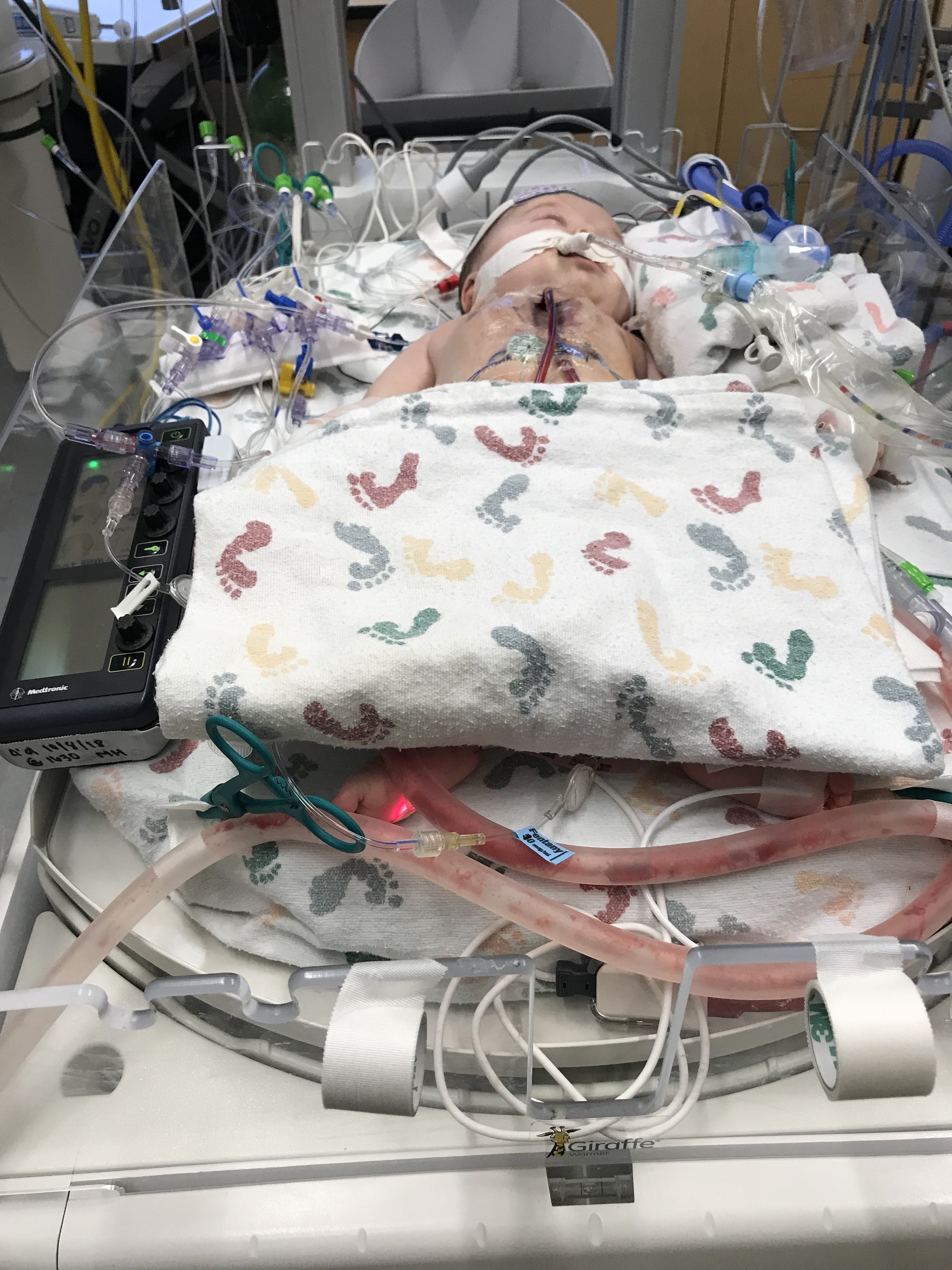 2nd surgery.
