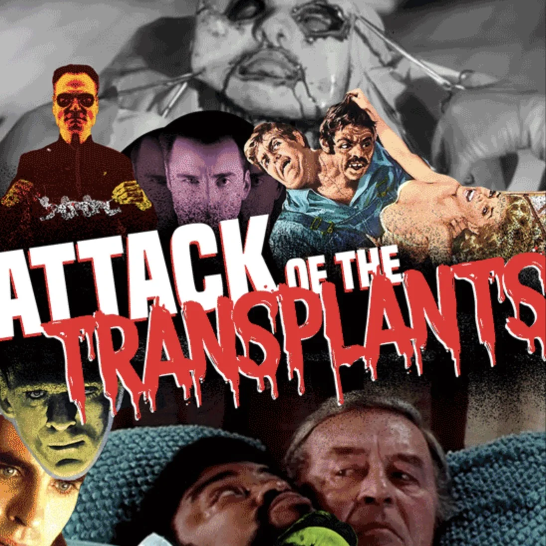 Episode 48: Attack of the Transplants episode artwork