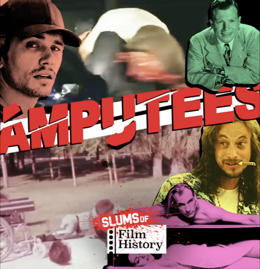 Episode 68: Amputees episode artwork