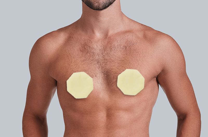 NipGuards Introduces NipGuards XL for Men With Huge Nipples
