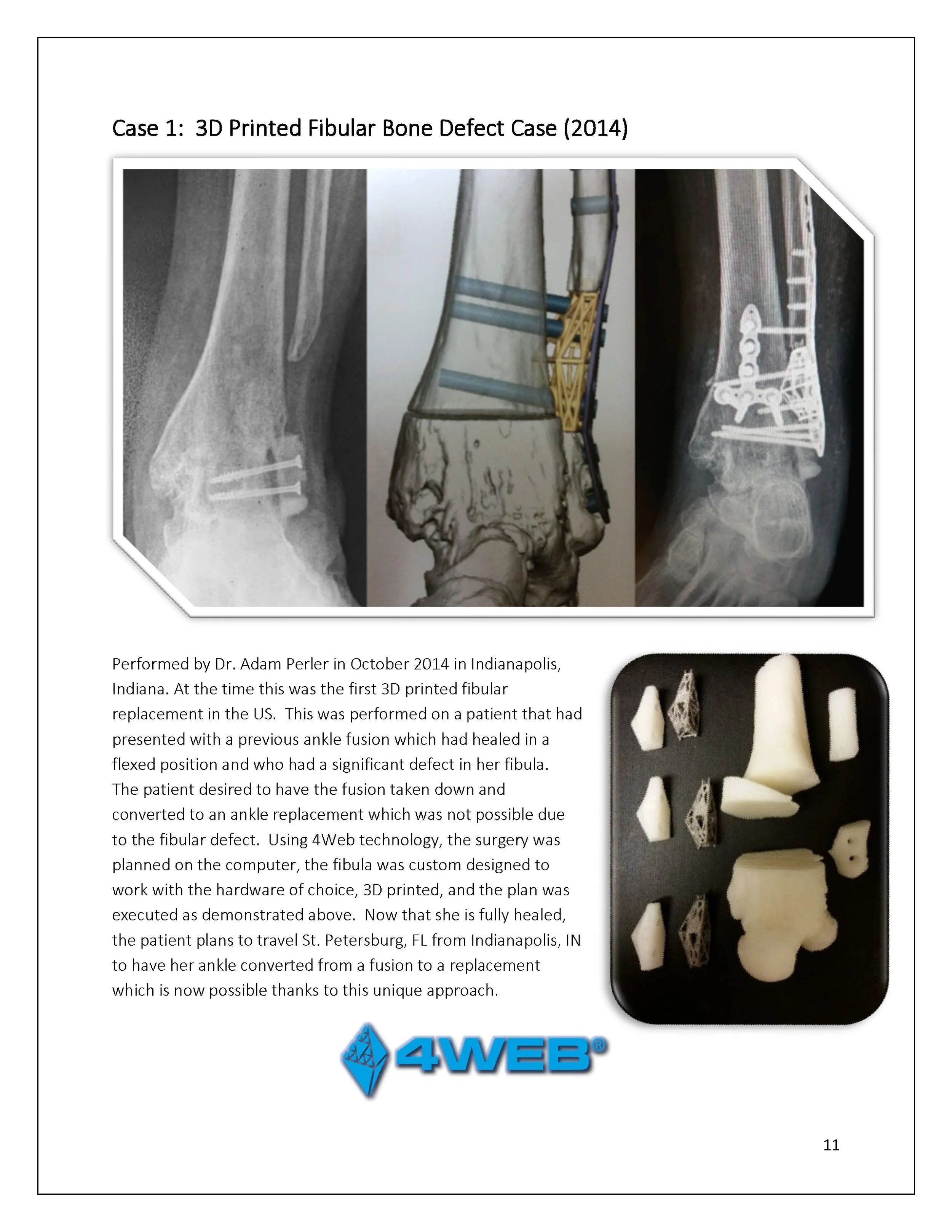 3D-Printing-AOA-Patient-Guide_Page_11.jpg