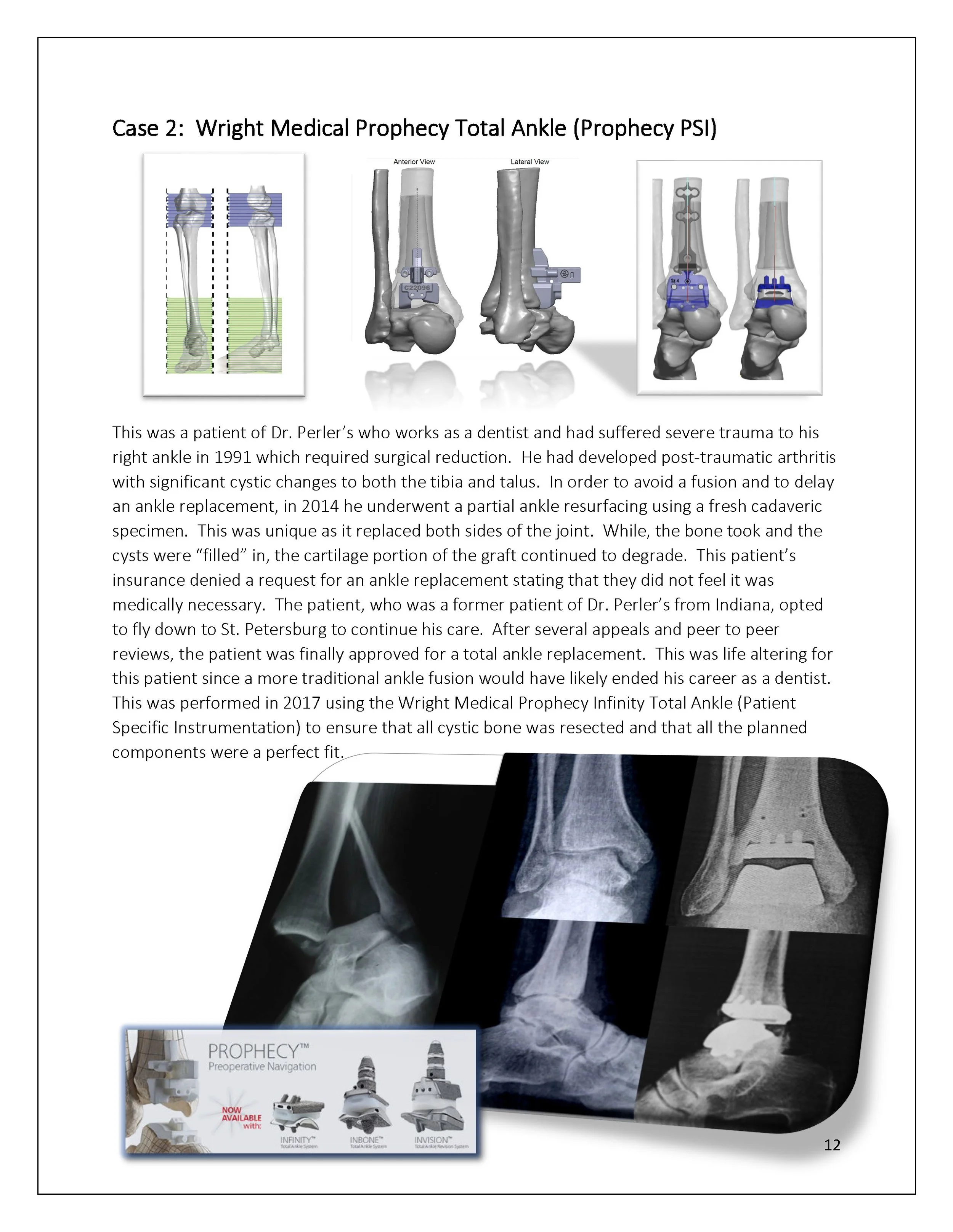 3D-Printing-AOA-Patient-Guide_Page_12.jpg