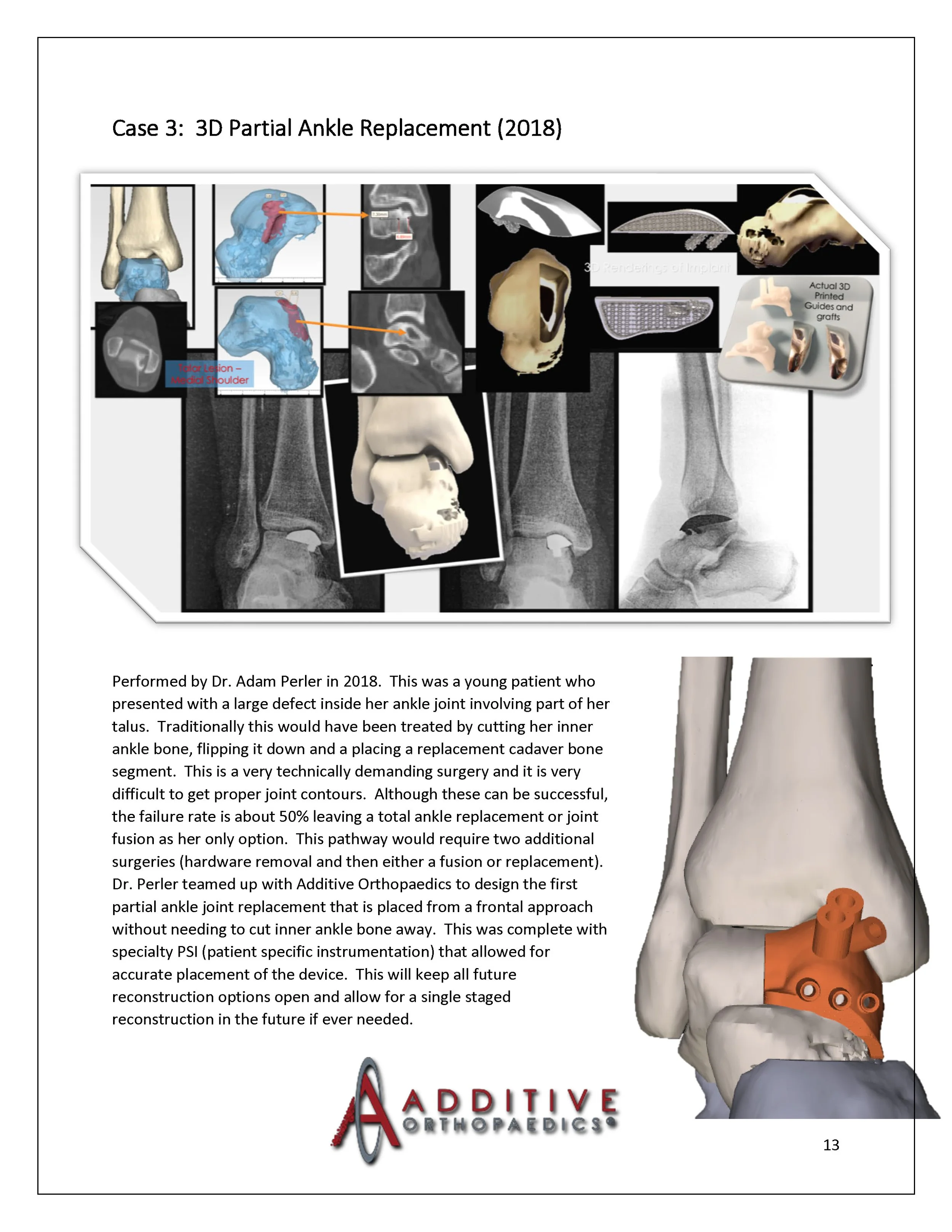 3D-Printing-AOA-Patient-Guide_Page_13.jpg