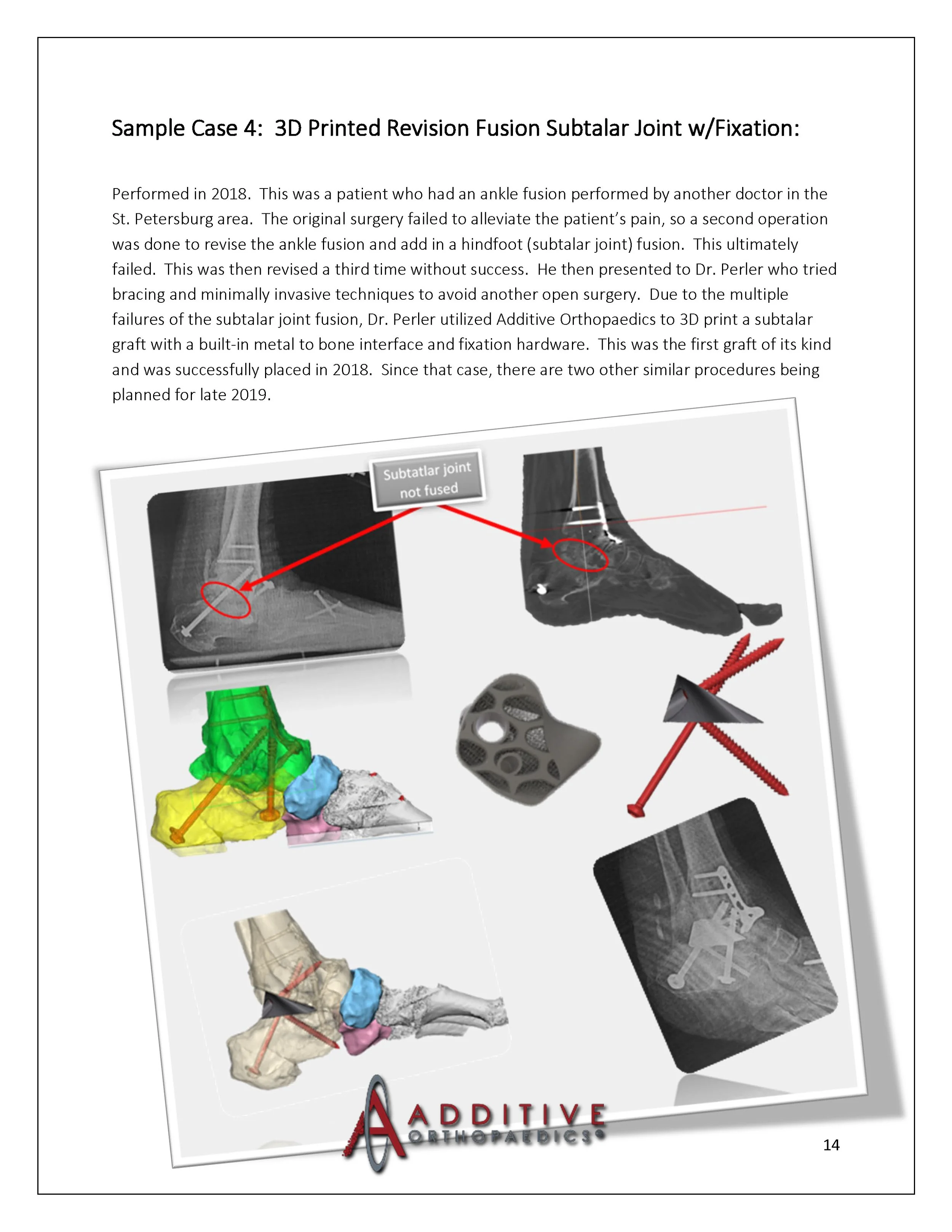 3D-Printing-AOA-Patient-Guide_Page_14.jpg