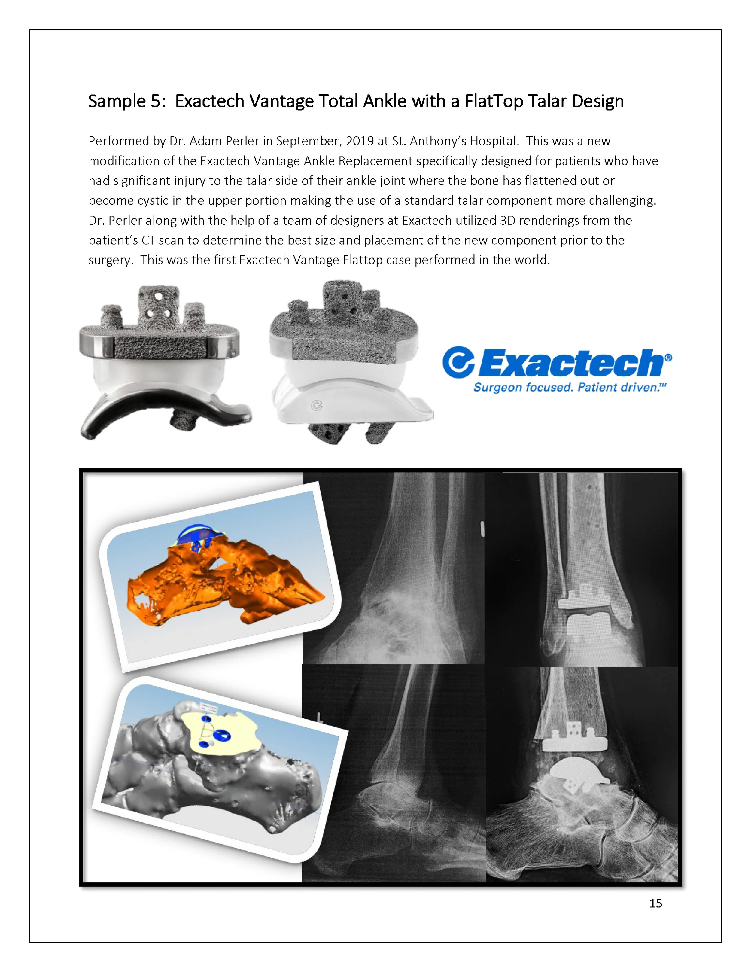 3D-Printing-AOA-Patient-Guide_Page_15.jpg